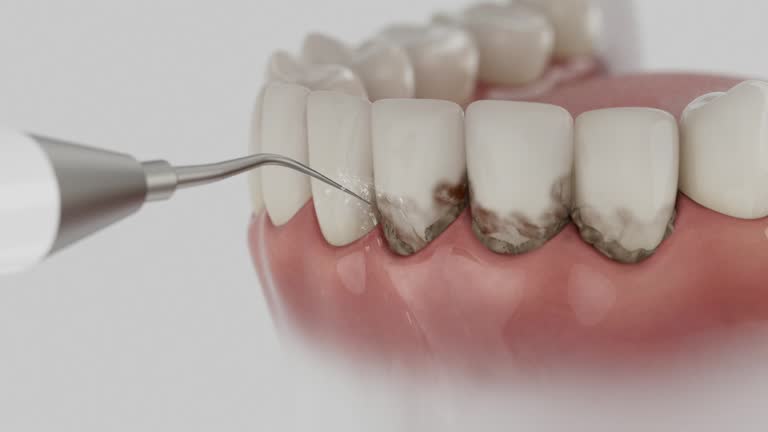Reliable Emergency Dentist contractor in Avila Beach, CA by Smile Center Dentistry